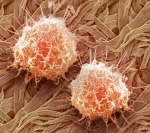 Obesity inhibits key cancer defense mechanism